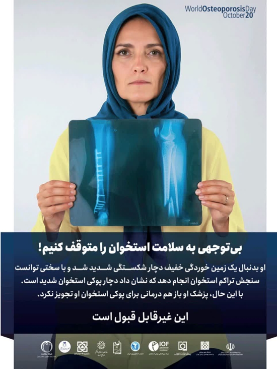پوکی استخوان